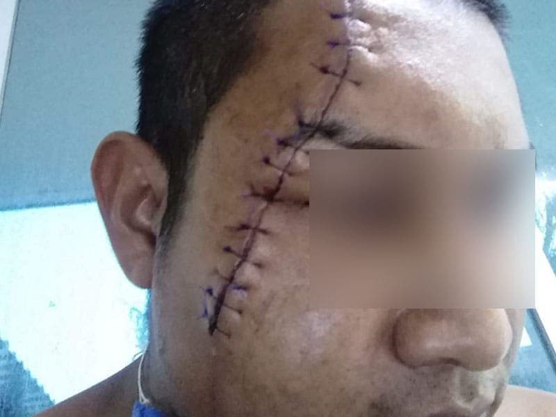 Por orinar en un lote baldío, hombre asegura que fue atacado por policías