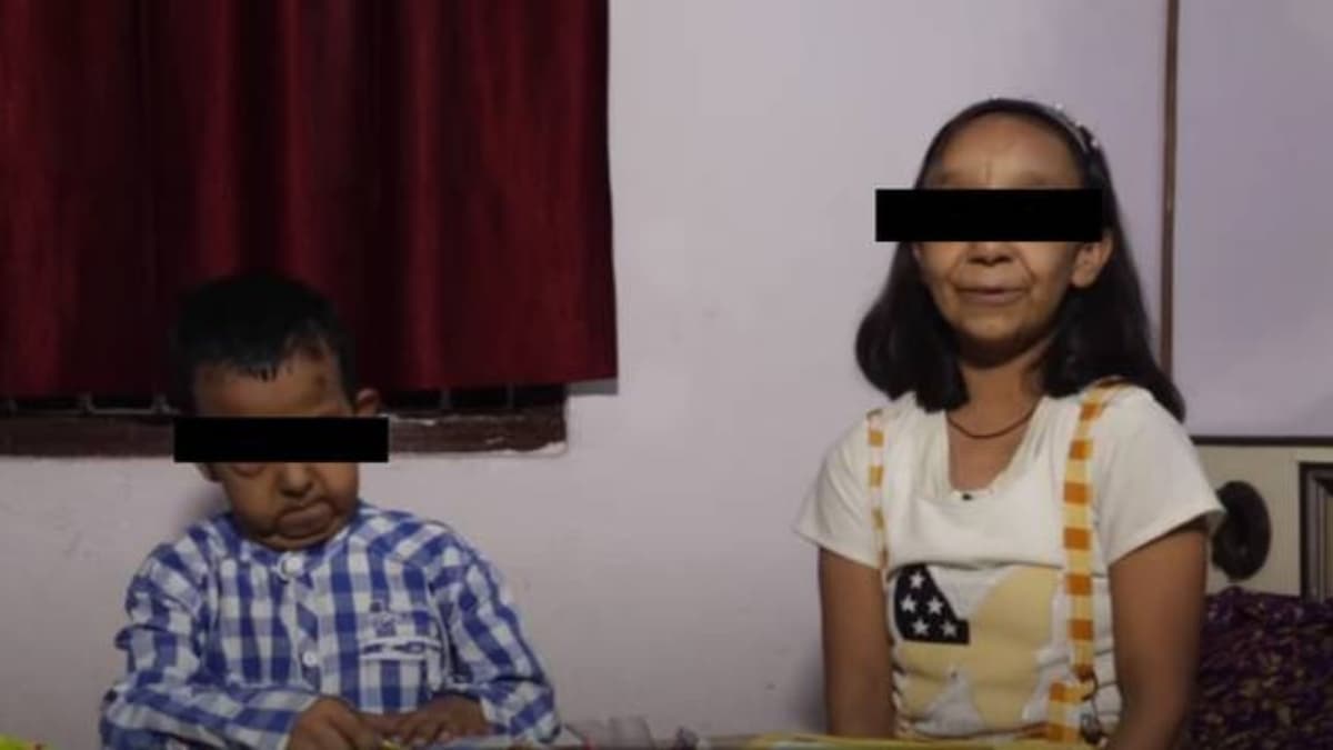 ¡Increíble! Hermanos de 5 y 11 años parecen viejitos por un trastorno genético