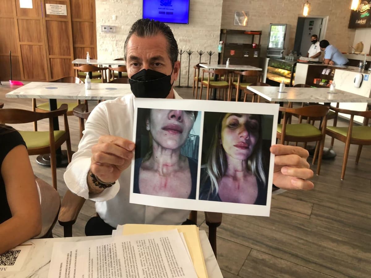 Denuncian a Sergio León, presidente de Coparmex Q. Roo por violentar a su esposa