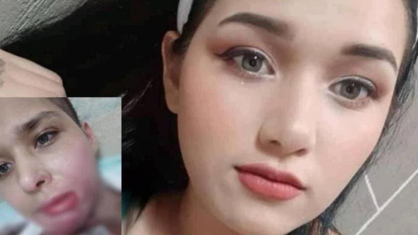 Joven de Nuevo León denuncia que fue secuestrada, violada y quemada