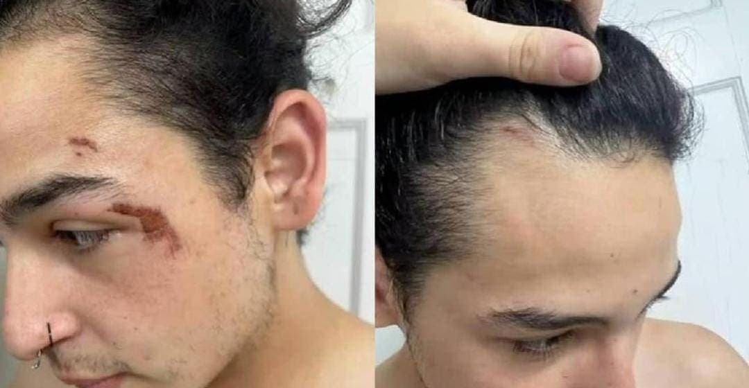 Hombre trans usa baño de mujeres; acaba siendo golpeado y arrestado