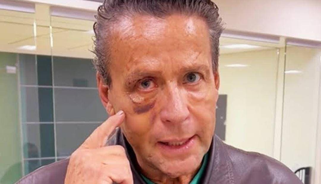 Operan de emergencia a Alfredo Adame debido a la golpiza que recibió