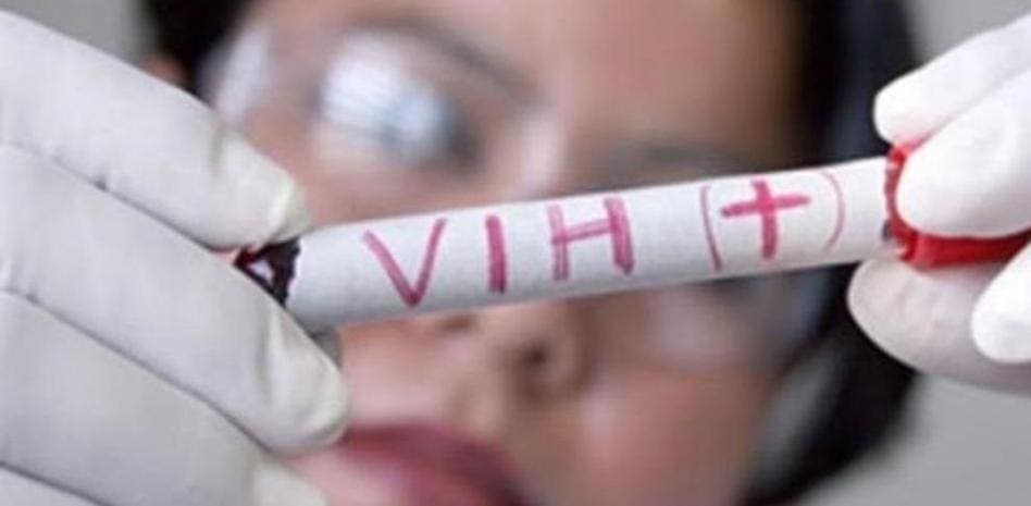 Tras trasplante de células madre, tercer paciente de VIH logra curarse por completo de la enfermedad