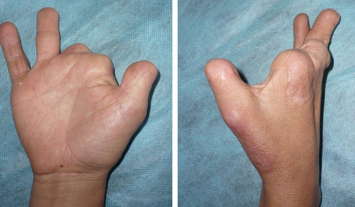 Desnudo y con dedos mutilados, abandonan a hombre en malecón de Cozumel