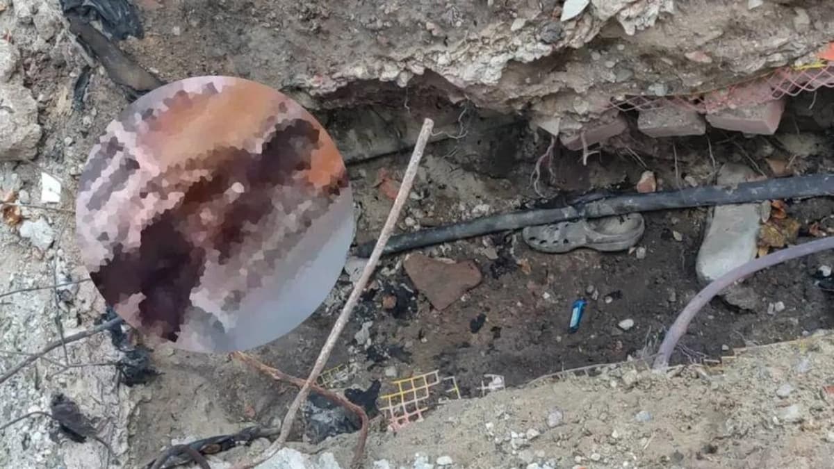 Ladrón intenta robar cables y termina con 90% del cuerpo quemado