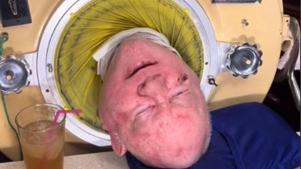 Muere Paul Alexander, hombre que vivió 70 años en un pulmón de acero