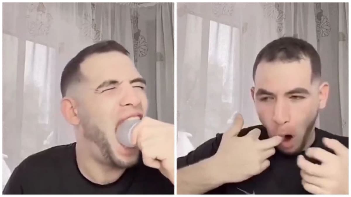 Video: Se mete un foco en la boca por un reto viral y parte del vidrio se le atora