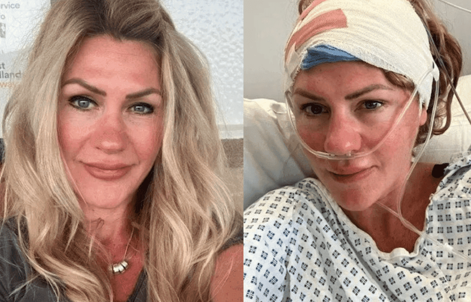 Mujer pensó que sus compañeros "hablaban un idioma diferente" pero resultó tener un tumor cerebral