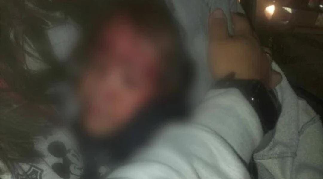 Video: Policía lesiona a una menor de cuatro años durante un operativo en Puebla