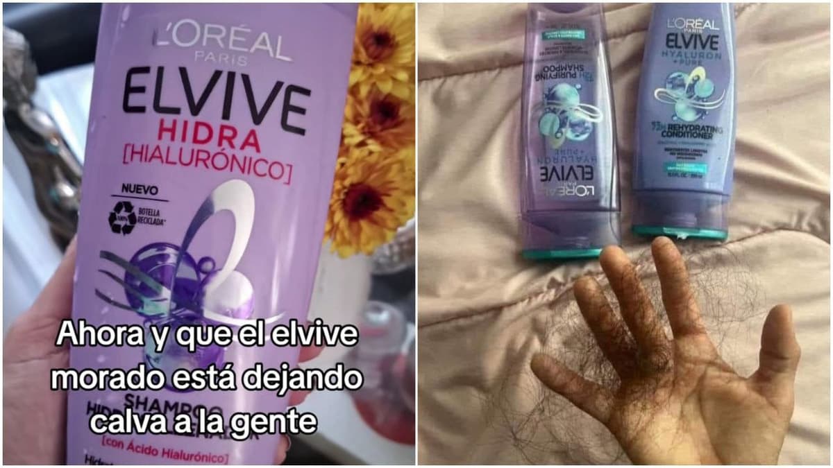 ¿Elvive morado provoca caída del cabello? Denuncian malas experiencias con shampoo de ácido hialurónico
