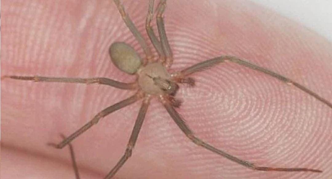 Sujeto sufre picadura de araña violinista en Puebla y le niegan la atención médica