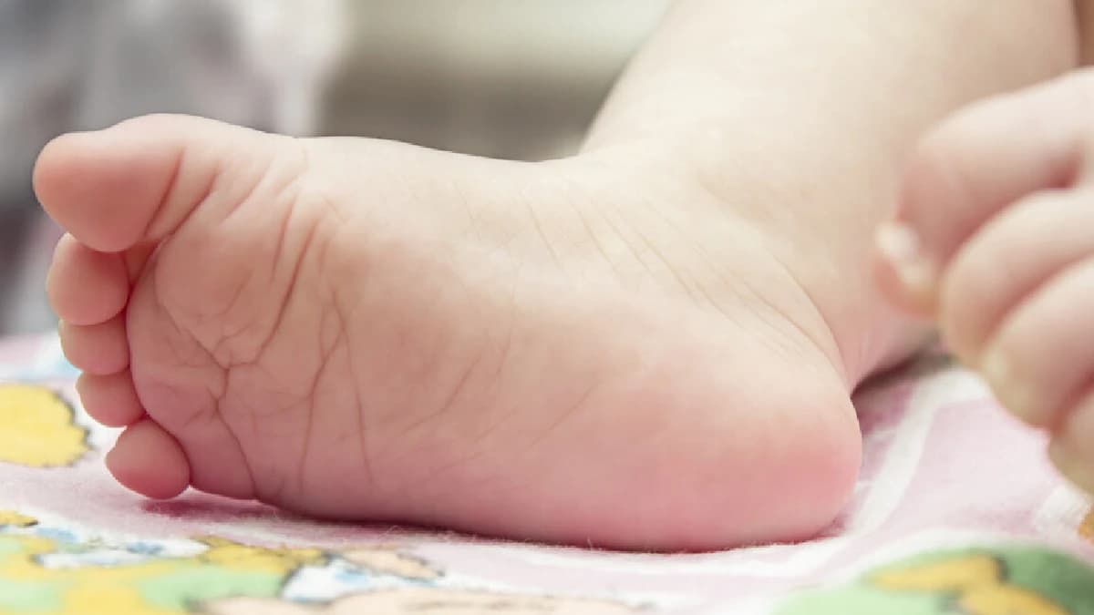 Bebé de un año muere al tragarse una pila electrónica en Monterrey, Nuevo León