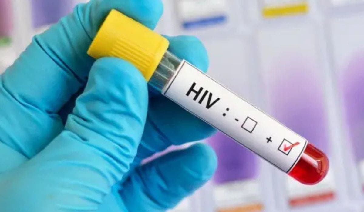 VIH: revelan por qué el virus persiste en algunos pacientes