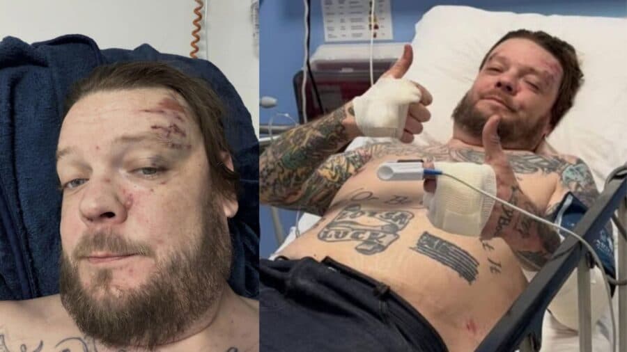 Corey Harrison de "El Precio de la Historia", sufre accidente en motocicleta y se rompe 11 costillas